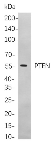 Anti-Recombinant PTEN, clone 5A1