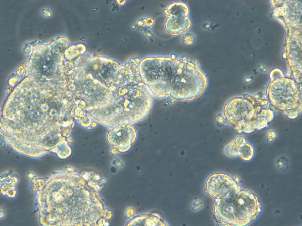 HROC278Met1 T2 M2 Cells