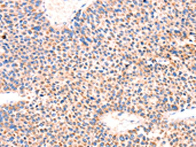 Anti-AMPD1