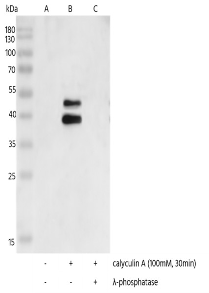 Anti-Phospho-MAPKAPK-2 (Thr334) Monoclonal Recombinant Antibody