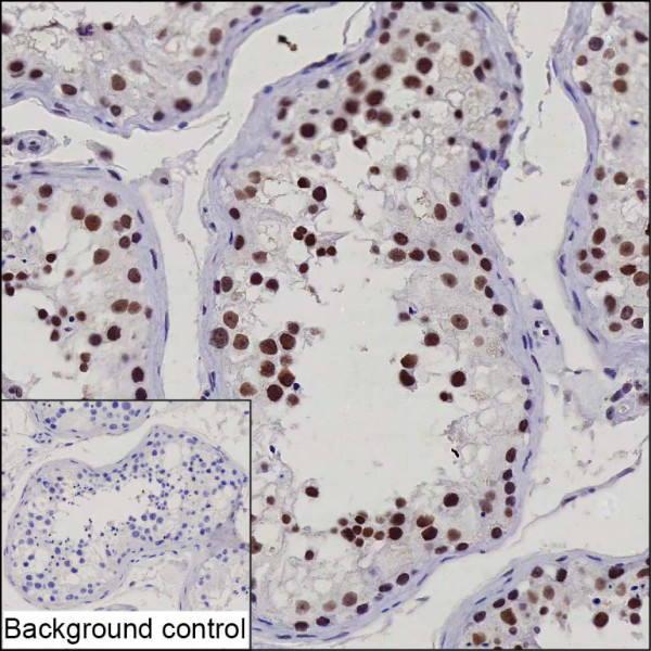 Anti-CPSF1