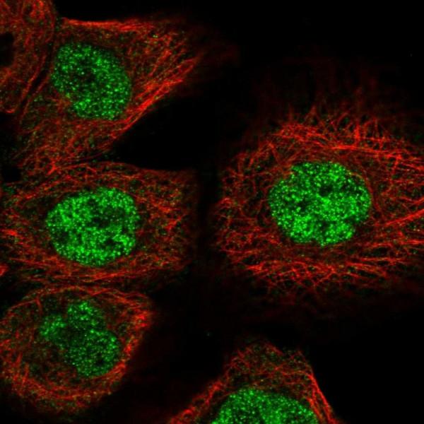Anti-GUCD1