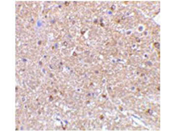 Anti-NogoA (Neurite Outgrowth Inhibitor Protein A)