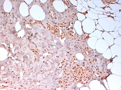 Anti-N Cadherin, clone 13A9