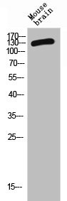 Anti-CD101