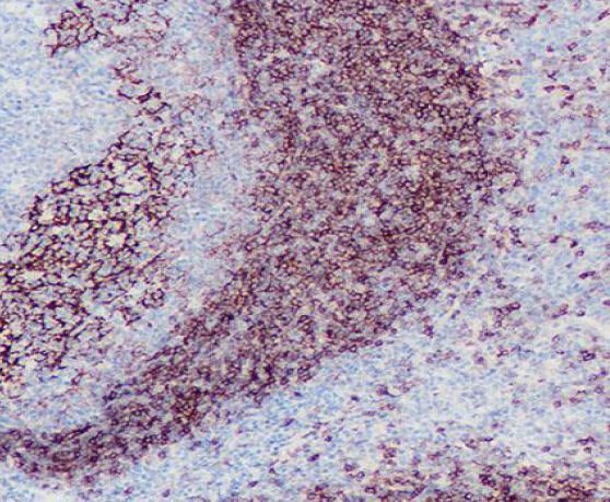 Anti-CD23, clone SQab1898