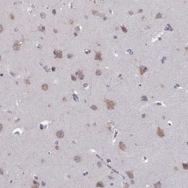 Anti-FAM234B
