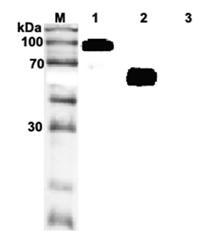 Anti-ST2 (human), clone ST33868