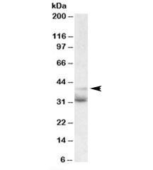 Anti-WNT4