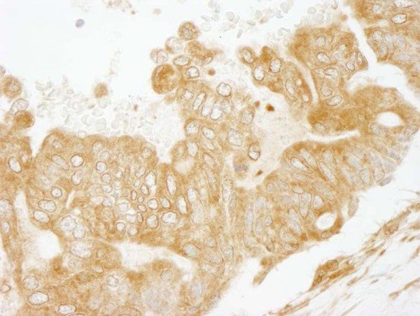 Anti-EEA1 (IHC)