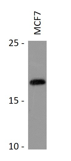 Anti-RPS19BP1 / AROS