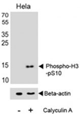 Anti-Histone H3 (phospho-S10)