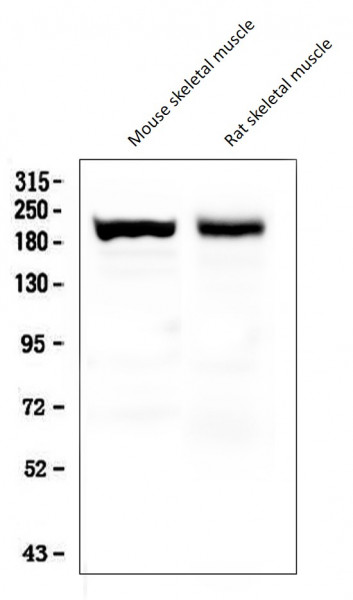 Anti-Slow Skeletal Myosin Heavy chain, clone NOQ7.5.4D