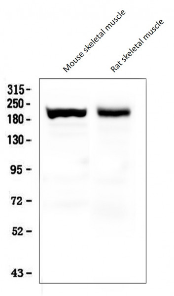 Anti-Slow Skeletal Myosin Heavy chain, clone NOQ7.5.4D