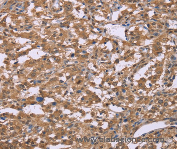 Anti-IFNA2