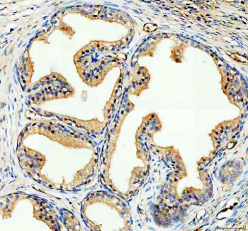 Anti-NCOA2 / Nuclear receptor coactivator 2