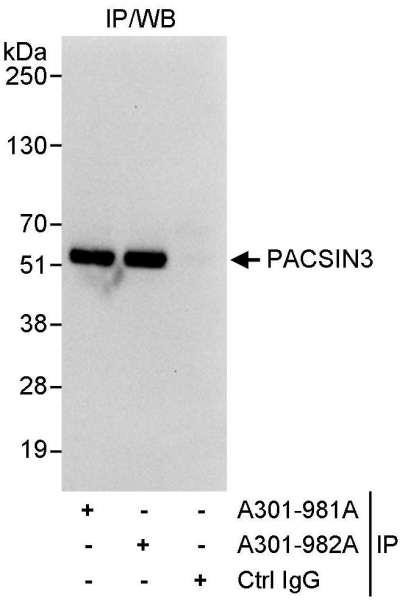 Anti-PACSIN3