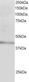 Anti-ARH / LDL receptor adaptor, N-terminal