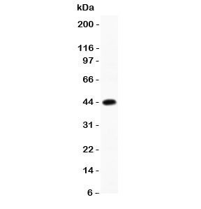 Anti-C/EBP beta