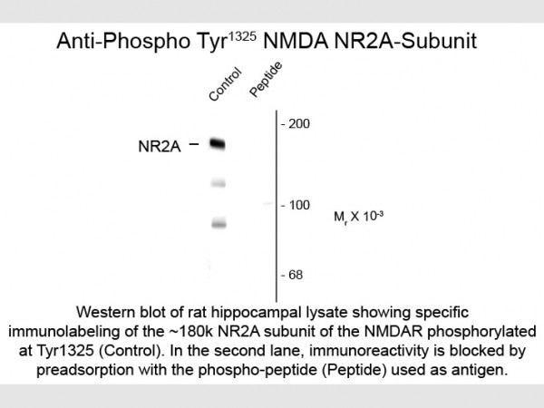 Anti-phospho-NMDA R2A (Thr1325)