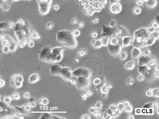 RenCa-IL2 Cells