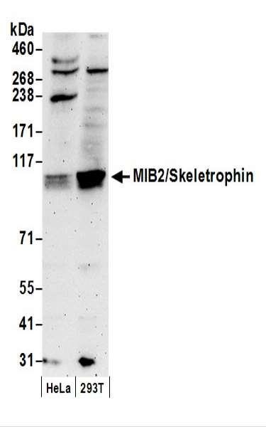 Anti-MIB2/Skeletrophin