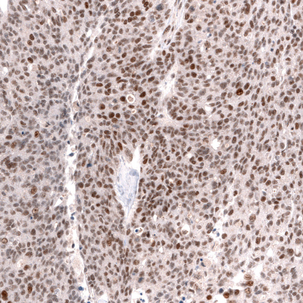 Anti-SMARCB1, clone CL13992