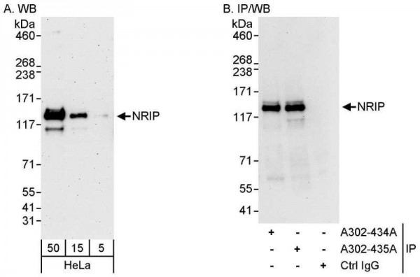 Anti-NRIP
