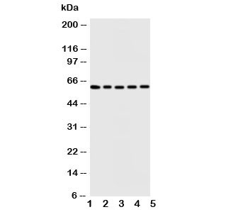 Anti-Iduronate 2 sulfatase