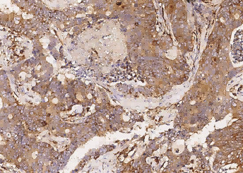 Anti-SIAE/sialate O-acetylesterase Monoclonal Antibody