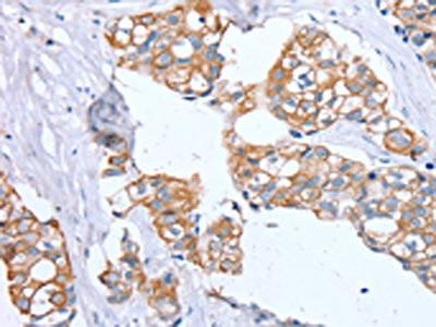 Anti-PTP4A2