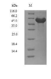 Dual specificity tyrosine-phosphorylation-regulated kinase 2 (DYRK2), partial, human, recombinant