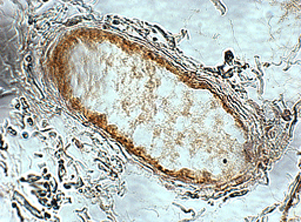 Anti-Adiponectin Receptor 1 (human) (AL238)