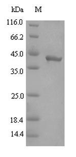 Gingipain R2 (rgpB), partial, Porphyromonas gingivalis, recombinant