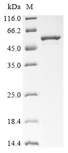 Melanoma-associated antigen B1 (MAGEB1), human, recombinant