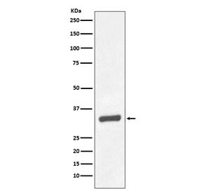 Anti-PSA / Prostate Specific Antigen, clone GDC-11