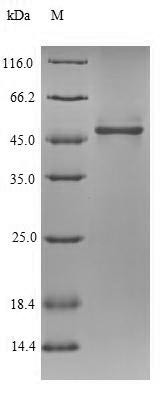 NADH-ubiquinone oxidoreductase 75KDA subunit, mitochondria (ND75),partial, Drosophila melanogaster,