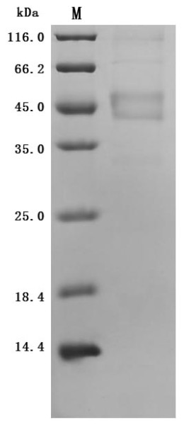 Melanoma-associated antigen 4 (MAGEA4) (Active), human, recombinant