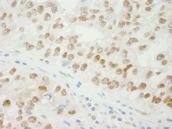 Anti-ADNP (IHC)