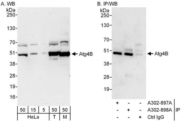 Anti-Atg4B