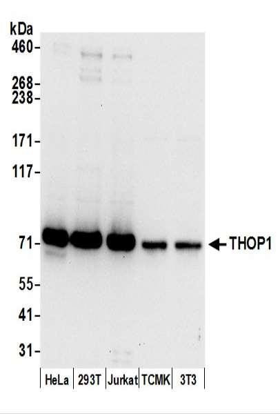 Anti-THOP1