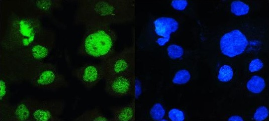 Anti-MED15 / PCQAP, clone 6F4