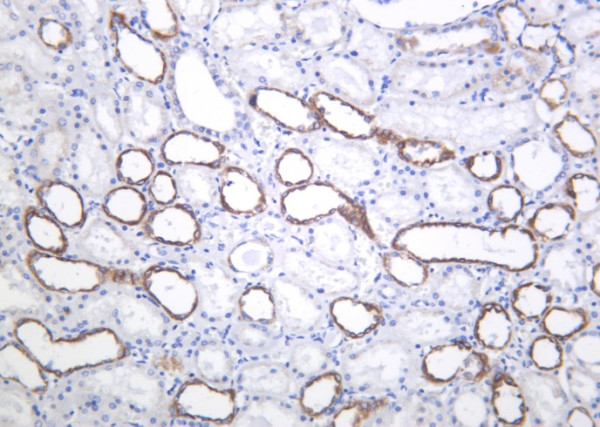 Anti-Recombinant PAI-1, clone 9B10