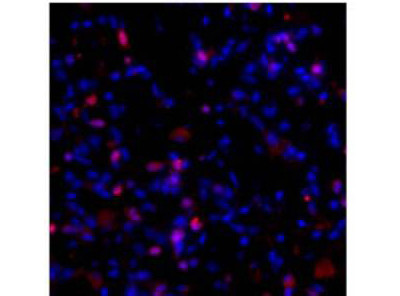 Anti-Collagen I, alpha 1 propeptide