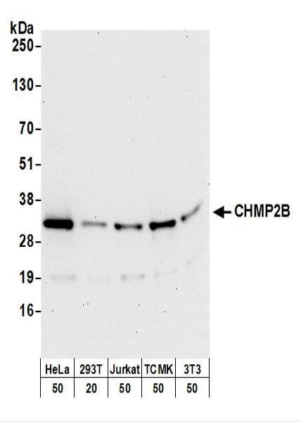 Anti-CHMP2B