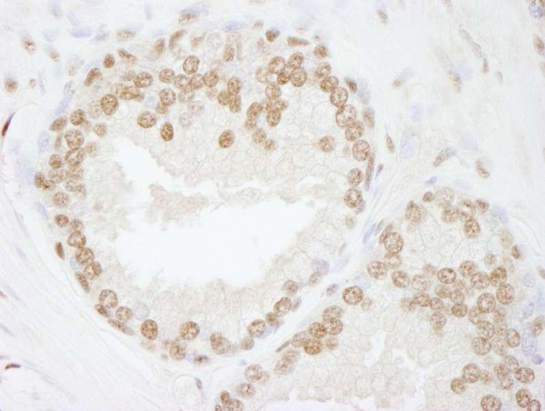 Anti-SMARCC2/BAF170 (IHC)