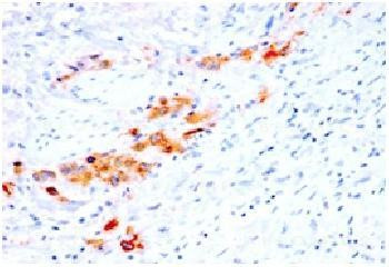 Anti-CD44v4 (Marker of Tumor Metastasis) Recombinant Mouse Monoclonal Antibody (clone:rCD44v4/1219)