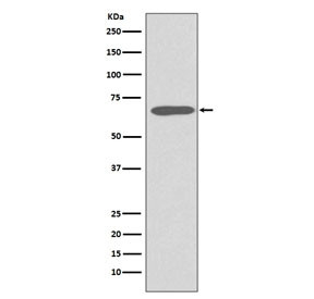 Anti-Keratin 1, clone GHO-11