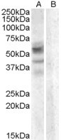 Anti-Arylsulfatase D, Internal