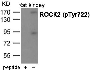 Anti-Phospho-ROCK2 (Tyr722)